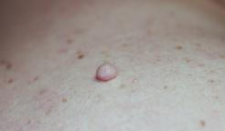 Fibrom