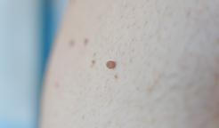 Fibrom