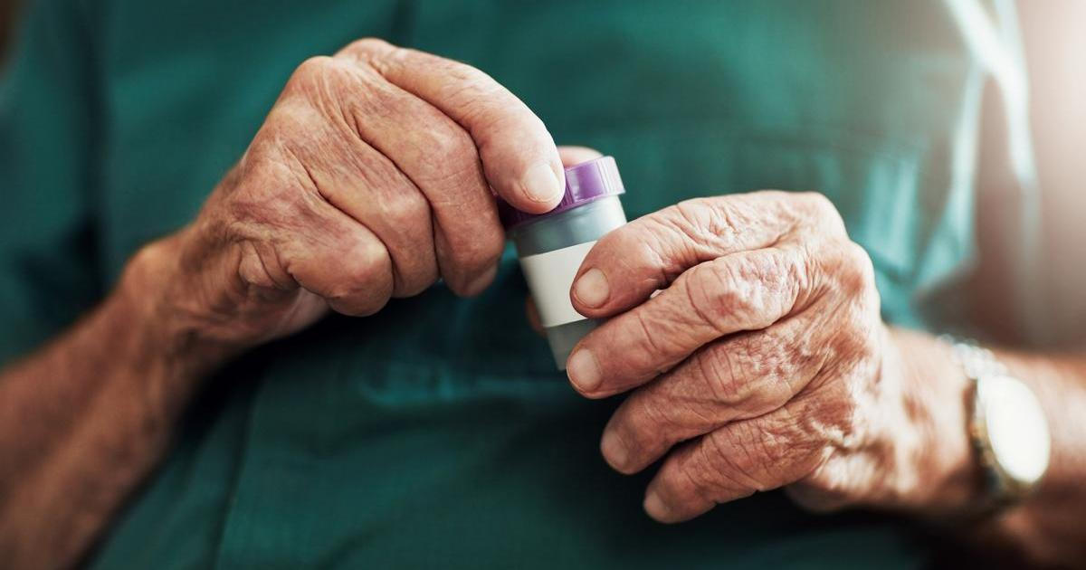 Alzheimerova choroba