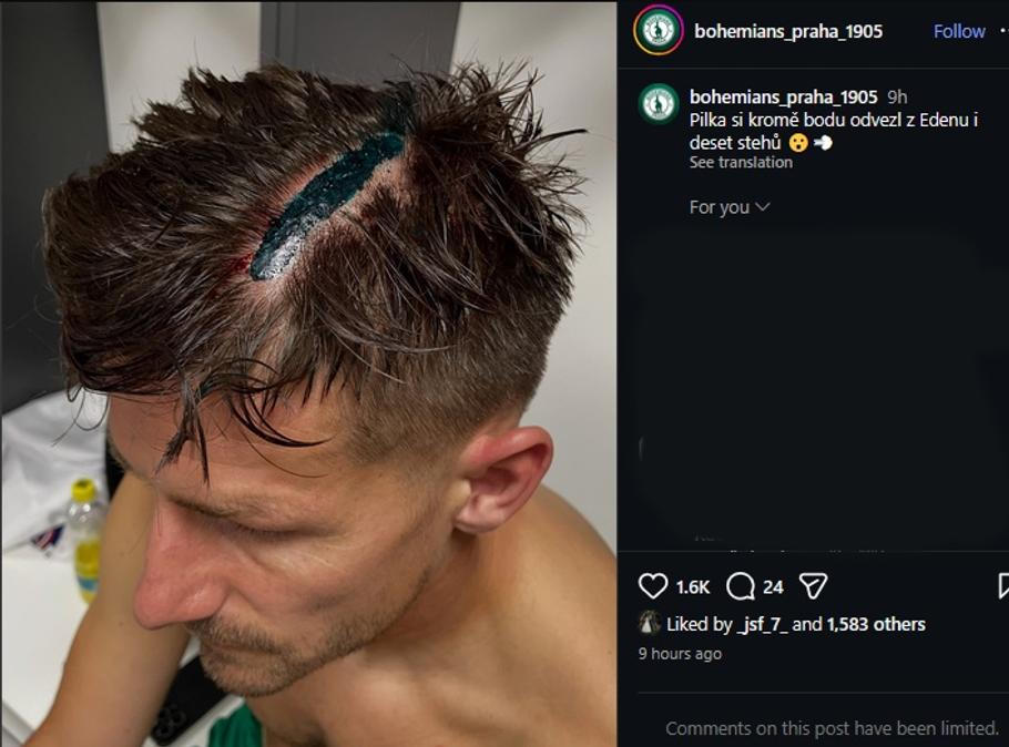 Stehy na hlavě Václava Pilaře