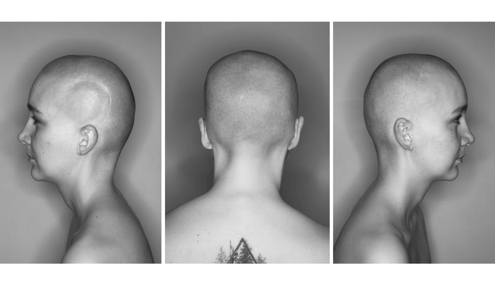 Výstava fotografa Pavla Máry představí i jeho nový a dosud nevystavený triptych Portrét E. Š. Velkoformátová fotografie hlavy mladé ženy s jizvou se stala i titulním snímkem výstavy.