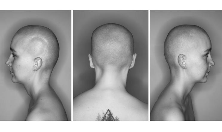 Výstava fotografa Pavla Máry představí i jeho nový a dosud nevystavený triptych Portrét E. Š. Velkoformátová fotografie hlavy mladé ženy s jizvou se stala i titulním snímkem výstavy.