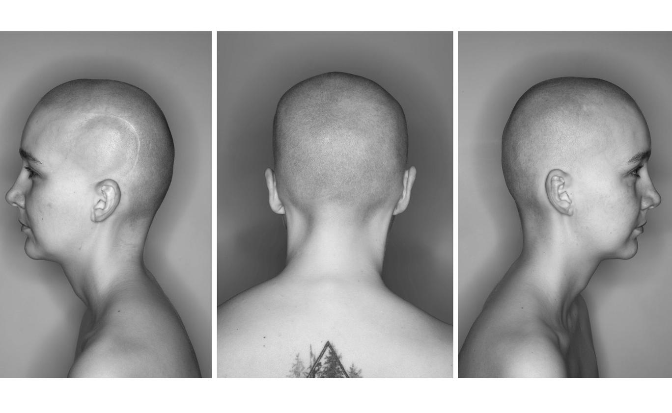 Výstava fotografa Pavla Máry představí i jeho nový a dosud nevystavený triptych Portrét E. Š. Velkoformátová fotografie hlavy mladé ženy s jizvou se stala i titulním snímkem výstavy.