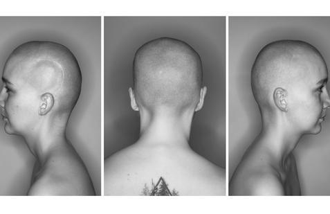 Výstava fotografa Pavla Máry představí i jeho nový a dosud nevystavený triptych Portrét E. Š. Velkoformátová fotografie hlavy mladé ženy s jizvou se stala i titulním snímkem výstavy.