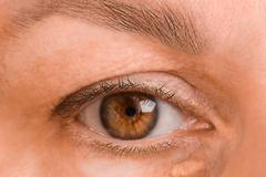 The,Left,Female,Eye,Of,A,Woman,With,Drooping,Eyelid,