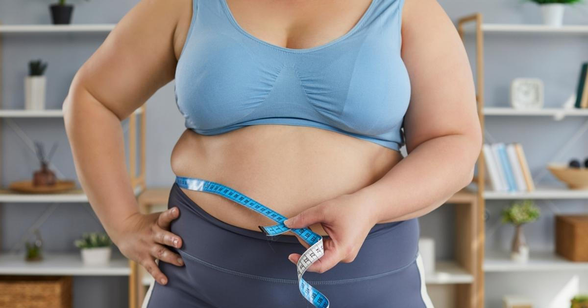 Shozená kila se nevrací kvůli selhání vůle. Tělo si pamatuje obezitu na úrovni buněk