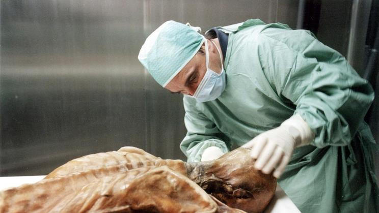 Ötzi - Alpský muž - ledovcová mumie pitva