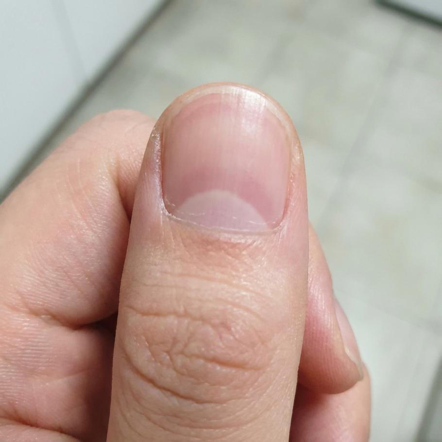 Lunula