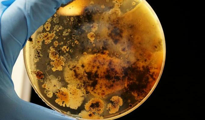 „Mor není nic, co by se dnes potřebovalo zkoumat v laboratoři – je to nemoc staletí známá a dobře popsaná. Nevidím tedy žádný důvod, proč by s ním měl někdo manipulovat ve výzkumném ústavu," říká epidemiolog Roman Prymula.