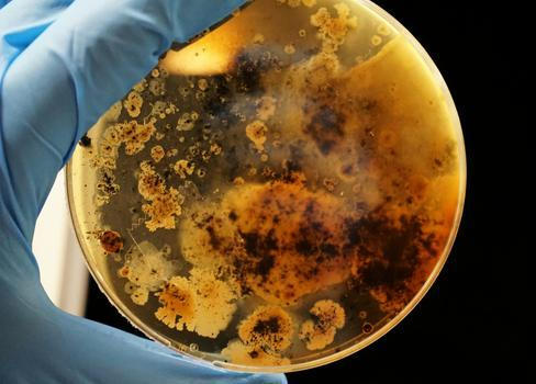 „Mor není nic, co by se dnes potřebovalo zkoumat v laboratoři – je to nemoc staletí známá a dobře popsaná. Nevidím tedy žádný důvod, proč by s ním měl někdo manipulovat ve výzkumném ústavu," říká epidemiolog Roman Prymula.