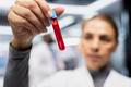 Woman scientist collecting and checking blood in test tubes